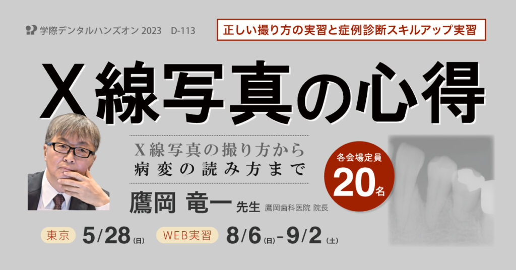 歯科セミナー｜鷹岡 竜一 先生「X線写真の心得　〜X線写真の撮り方から病変の読み方まで〜」