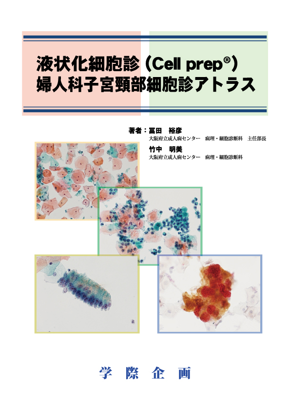 【書籍】液状化細胞診（Cellprep®）婦人科子宮頸部細胞診アトラス