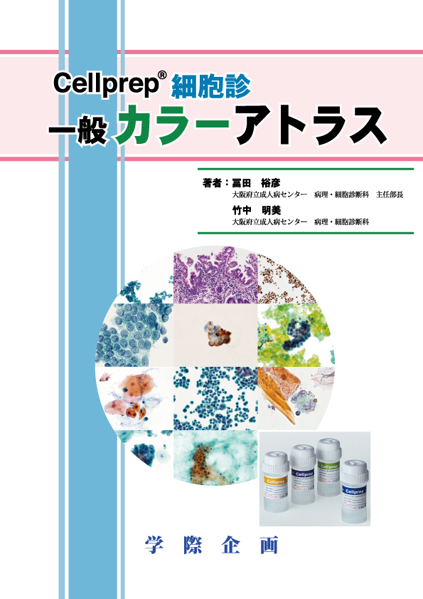 【書籍】Cellprep®細胞診 一般カラーアトラス