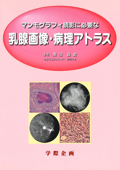 【書籍】マンモグラフィ読影に必要な乳腺画像・病理アトラス