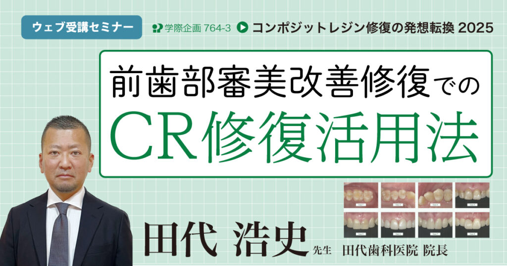 前歯部審美改善修復でのCR修復活用法