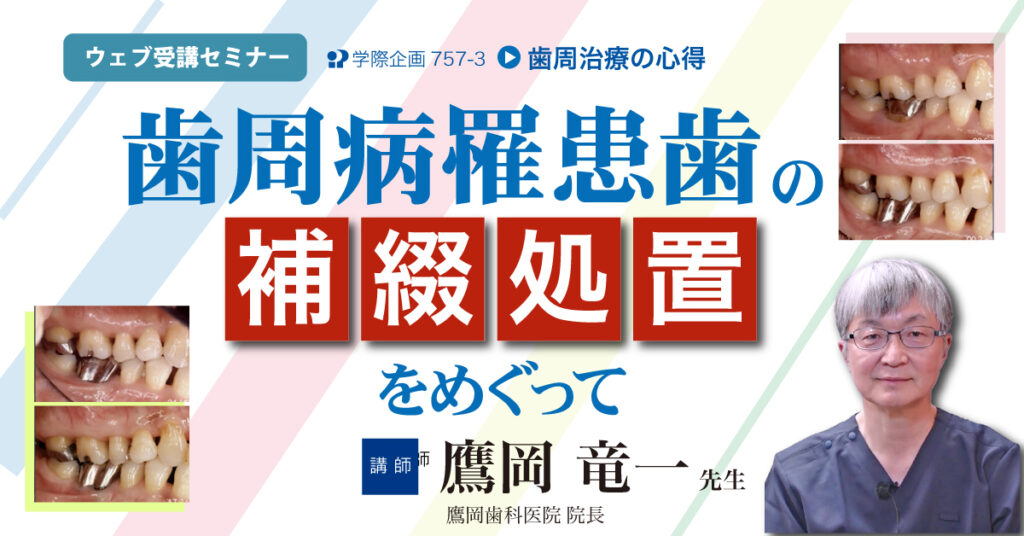 歯周病罹患歯の補綴処置をめぐって